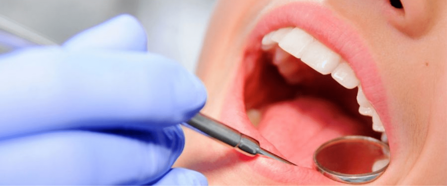 Endodontie (traitement du canal radiculaire)